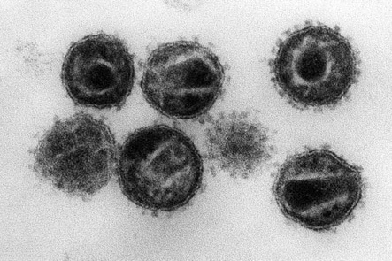 消化管マイクロバイオームがHIV感染者の健康に及ぼす影響